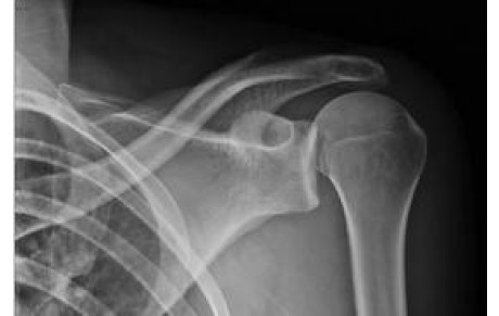 La série noire continue...